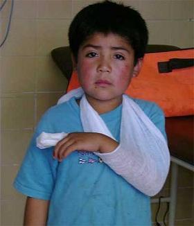 Escandalosa represión: Carabineros hirió de bala a un niño mapuche de de 10 años