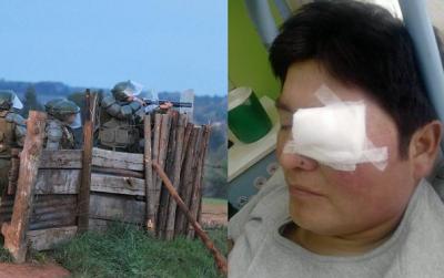 7 jóvenes y 2 niños heridos por ataques de la Policía en Temucuicui